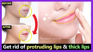 How to get rid of Protruding Mouth and Lips naturally | Make Thick lips to Thin lips with exercises.