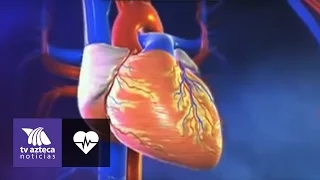 Síntomas antes de un infarto cardiaco