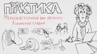 Мелкоклеточный рак лёгкого. Локальная стадия