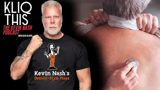 Kevin Nash on IF he has trouble breathing