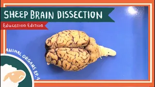 Brain Dissection || Always on My Mind [EDU]