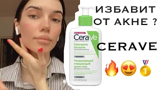 ИЗБАВИТ ОТ ПРЫЩЕЙ ЗА ДЕНЬ ? 😱CERAVE НАШУМЕВШАЯ УМЫВАЛКА