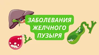 Заболевания желчного пузыря | желчекаменная болезнь (виды, диагностика)