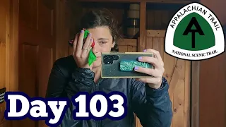 Waking Up At The Hut With My Eye Swollen Shut 😳 | Appalachian Trail Thru-Hike 2023