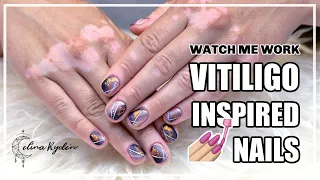 REAL-TIME WATCH ME WORK! VITILIGO INSPIRED NAILS | GEL NAILS TUTORIAL | MANICURE