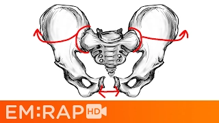 Bad Pelvic Fractures