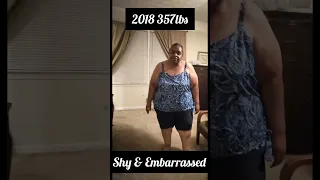 Before and After Motivation on my Weight Loss Journey to Lose 180lbs Naturally with Diet & Exercise