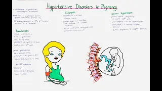Hypertensive Disorders in Pregnancy - Preeclampsia, Eclampsia, Gestational Hypertension