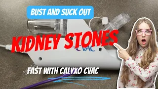 No more PCNL for kidney stones? Calyxo's new CVAC may be the key | AUA 2024