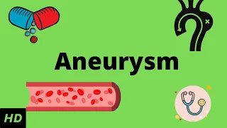 Aneurysm, Causes, Signs and Symptoms, Diagnosis and Treatment