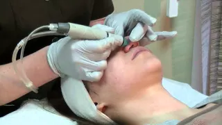 Гидропилинг, процедура гидропилинга, косметолог Елена Хлопова.