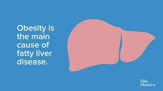 Fatty Liver Disease: An (Animated) Explanation