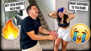 DISGUSTING PEELING SKIN PRANK ON GIRLFRIEND! *FREAKS OUT*