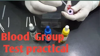 Blood Group Test Practical | Procedure for determination of blood group | blood group test