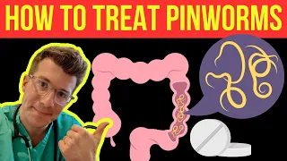 Doctor explains HOW TO TREAT PINWORMS (aka threadworms)
