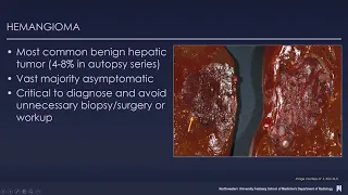 Imaging  findings in liver lesions