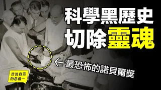 科學黑歷史：切除腦子的手術，竟然還得過諾貝爾獎……|自說自話的總裁