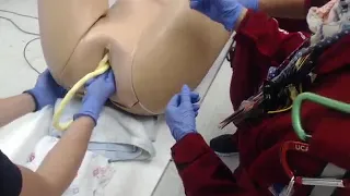 Umbilical Cord Prolapse