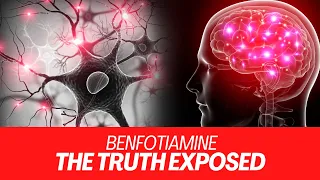 BENFOTIAMINE: The Truth Exposed