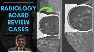 Breast Imaging - Case Based Approach | Radiology Board Review | Set 8 | May 2021