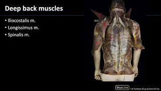 MSK Lab 1 Station 20 - Deep Back Muscles