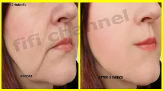 Miracle seeds, to get rid of wrinkles and tighten sagging cheeks, for young skin, 10 years younger