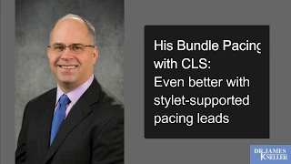 His Bundle Pacing with CLS: Even better with stylet-supported pacing leads