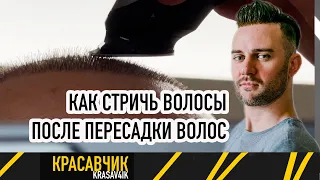 Как правильно стричь волосы после пересадки волос? / Красавчик