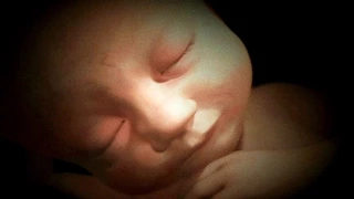 Dreaming in the Womb - 33 Week Fetus