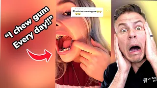 Orthodontist Reacts! Chewing Gum With Braces!