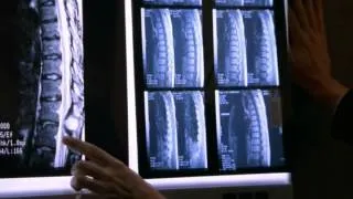 Medical.Cases.Special.rus.LostFilm.TV.avi