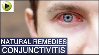 Conjunctivitis (Pink Eye) - Natural Ayurvedic Home Remedies