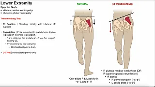 Trendelenburg Test | Rationale & Interpretation