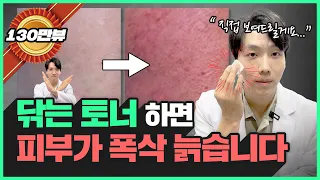 토너(스킨) 올바른 사용 방법☝🏻| 닦토는 제발 하지 마세요ㅠㅠ