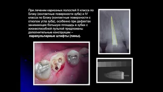 Пропедевтика стом. заболеваний 2. Восстановление коронок с использованием внутриканальных штифтов