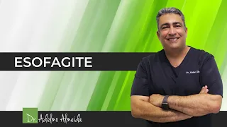 Vamos falar sobre esofagite?