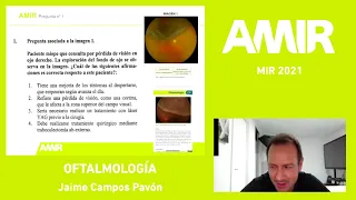 MIR 2021 | Oftalmología | Jaime Campos Pavón