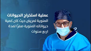 عملية استخراج الحيوانات المنوية لمريض حيث كان كمية حيواناته المنوية صفرًا لمدة اربع سنوات