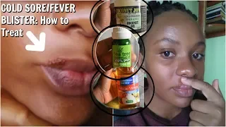 How I Treated This COLD SORE /FEVER BLISTER NATURALLY OVERNIGHT plus my cold sore stages