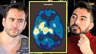 ESTO es lo que le pasa al cerebro de una persona con DEPRESIÓN - Neurocirujano y la mente dañada