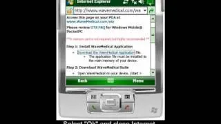 Wave Medical Installation for Windows Mobile Pocket PC