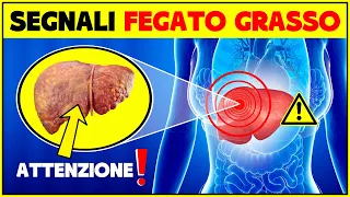 Sintomi fegato grasso - Attenzione ai segnali che il fegato ti manda | Steatosi epatica non alcolica