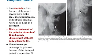 week 40 skeletal trauma