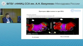 Защита диссертации Аванесян Г. А.