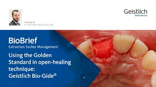 Extraction Socket Management - Golden Standard in open-healingtechnique: Geistlich Bio-Gide®