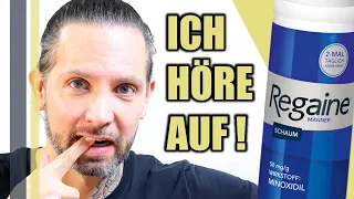 MINOXIDIL: DARUM HÖRE ICH MIT REGAINE AUF NACH 2 HAARTRANSPLANTATIONEN – GREY YOUNG