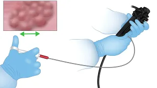 Endoscopy Technology Theory-Lesson 11-Handling Accessories