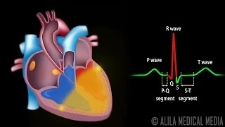 Système de conduction cardiaque et compréhension de l'ECG; Animation.