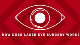 How Does Laser Eye Surgery Work? | Earth Science