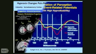 Use of Hypnosis To Alter Perception